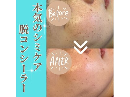 クリニカルホワイトケア 福岡店(クリニカルWHITEケア)の写真