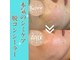 クリニカルホワイトケア 福岡店(クリニカルWHITEケア)の写真