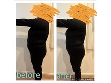 ヨサパーク リープ(YOSA PARK Leap)/水素まみれコースのbefore after