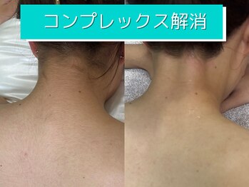 プラネット(Planet)/悩みを解消し自信へ