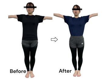 ブライトプラス(BRIGHT+)/ダイエットコース