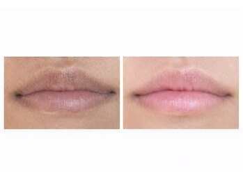 ワイスタイル(Ystyle)/ローマピンク　【唇】1回