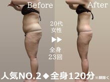 ルナステラ 七尾店の雰囲気（肉質、完全支配！サーモシェイプならガチガチ脂肪も全身造形。）