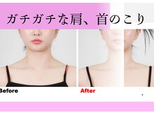 エステティック ミュー(Esthetic MiEUX)/肩こり、首こり根本改善