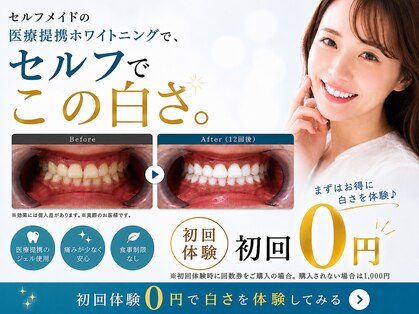 セルフメイド 宇部本店(SELFMADE)の写真