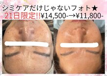 サロンツキ(salon tuki)
