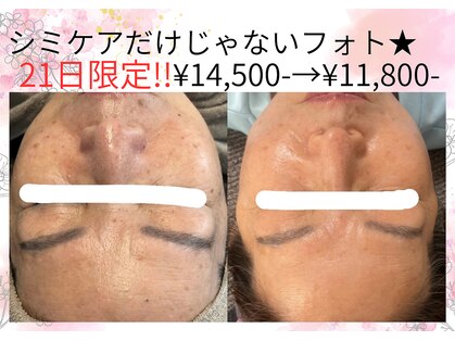 サロンツキ(salon tuki)の写真