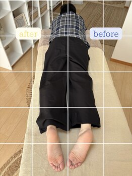 ルミナフローム(LuminaFlowm)/ビフォーアフター