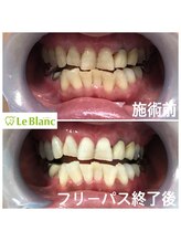 ルブラン 奈良店(Le Blanc)/頑張って通って頂きました！