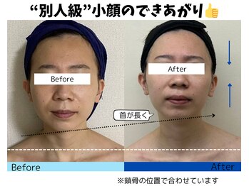お顔の研究所/ビフォーアフター写真♪