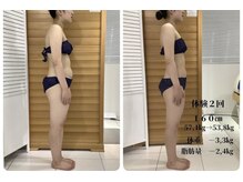 エゴ(EGO)/20代　体験2回コース結果