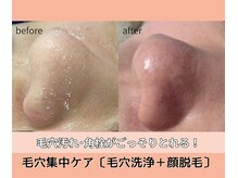 ベルミーランド 浜松天王/フェイシャルBefore→After