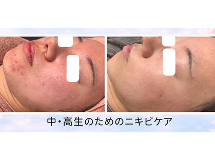 エステルクリア(esther clear)の写真