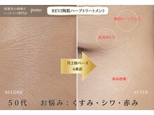 ポノ 甲府本店(pono)/REVI陶肌ハーブトリートメント