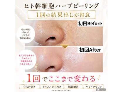 ウル(Uru)の写真