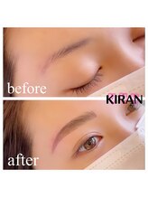 キラン(KIRAN)/ミラノスタイルブロウリフト