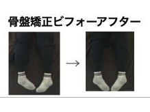 やち鍼灸院/骨盤を整えて美脚に！