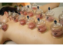 ブリリアント(Brilliant)/カッピングで不調をスッキリ解消