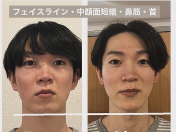 ナチュラルセラピー ドロップ(Drop)/美骨形成術で左右差を改善