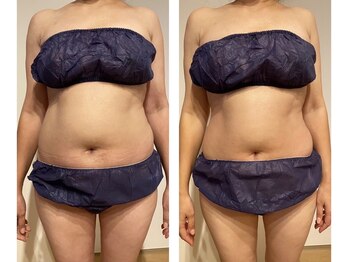 スリールダンジュ(sourire dange)/WINBACKで劇的サイズダウン♪