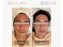 パルタージュ(Partage)/