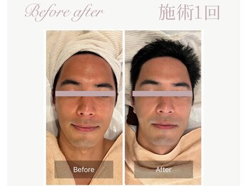 パルタージュ(Partage)/