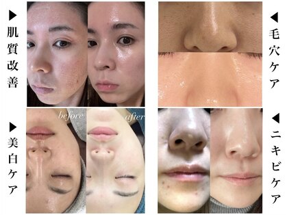 グロッシー(glossy)の写真