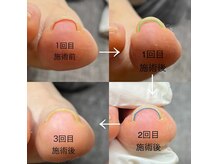 フー(HUU.)の雰囲気（巻き爪ケア、タコやウオノメなどフットケアもおまかせください！）
