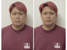 寝屋(neya)/小顔矯正比較