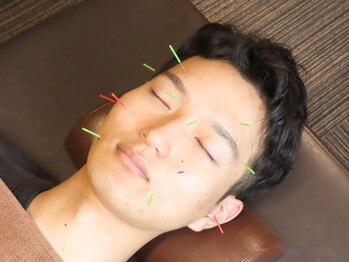 リカバリー整体院 太宰府院/美容鍼