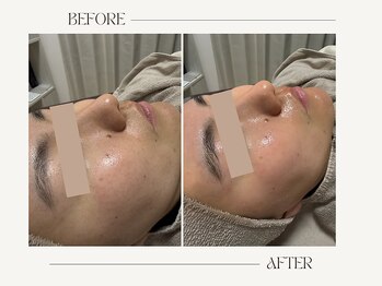 リアン(Rien)/Before/After