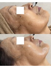 オーラ(aura)/80代のお客様の変化
