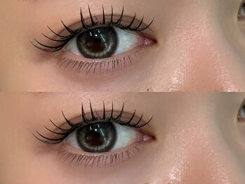 アイミー(eyeme)の写真/理想の目元を叶える、納得のボリューム感！プロの技でまつげの悩みに寄り添い、魅力的な表情を演出します♪