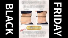 ホワイトビューティーラボ(White Beauty Lab)
