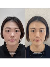 ラ クレール ビューティーサロン(LA CLAIR)/小顔リフトマシン豊富に取り揃え