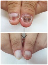 ココ ネイル サロン アンドスクール(COCO.NAIL SALON＆SCHOOL)/爪育成
