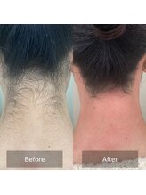 トゥルーリー(TRULY)/《うなじワックス》