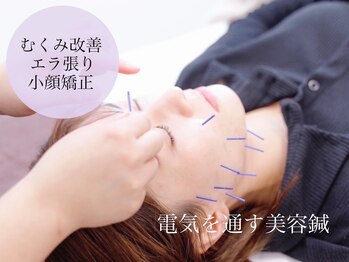 ダンダン(Dandan)/電気を流す美容鍼