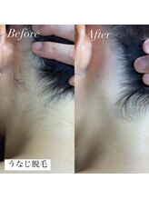 アース コアフュールボーテ 新潟中野山店 (EARTH Coiffure beaute')/うなじ脱毛