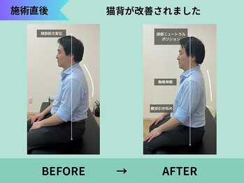 トミーリハ整体院(TOMMY REHA整体院)/猫背/巻き肩/姿勢改善もお任せ！