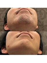 フェリーバ 流山店(FELIVA)/しぶといお髭、得意です(^^)