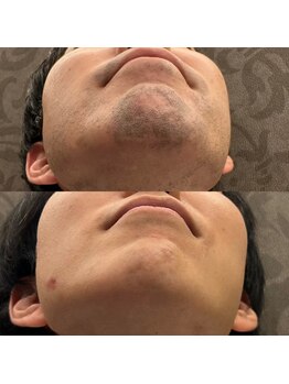 フェリーバ 流山店(FELIVA)/しぶといお髭、得意です(^^)