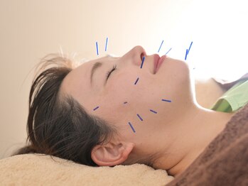 ハートフル鍼灸院の写真/【野田の隠れ家鍼灸院】野田阪神スグ！美容鍼と女性特有のお悩みに特化◎お得なクーポン盛り沢山♪