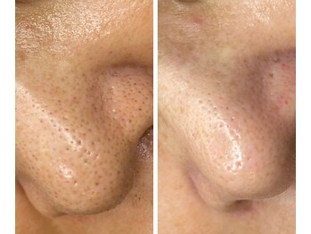 サイ(Sai)/before⇒after