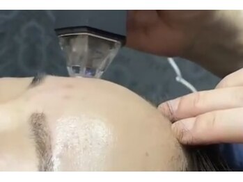 トムズ(Tom’s)/最先端プラズマで肌は変わる♪