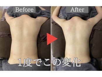 オレンジ(Orange)/[上半身集中]筋膜＆アロマリンパ