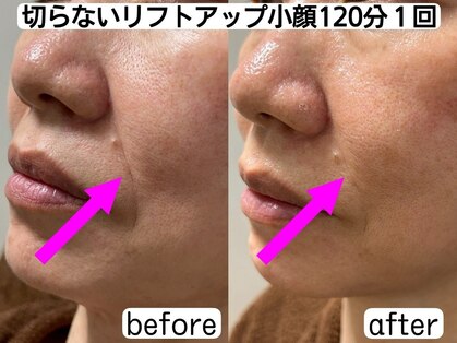 ユーフォリア(Euphoria)の写真