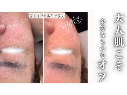 ミーサ(Mysarest)の写真