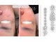 ミーサ(Mysarest)の写真