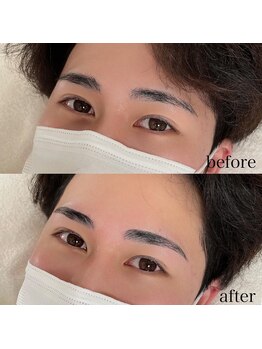 ダリ(Dali)/メンズハリウッドブロウリフト